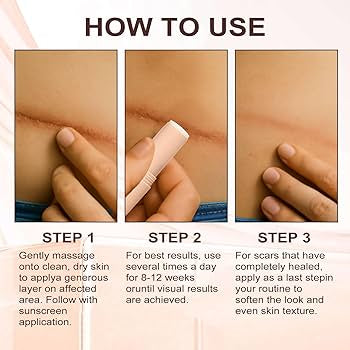 Silicone Scar Care Stick Nourishing
