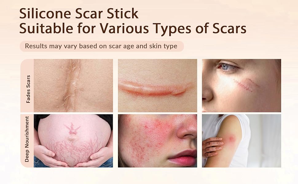 Silicone Scar Care Stick Nourishing