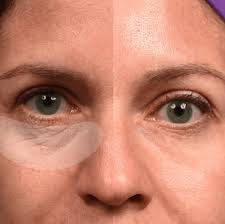 Silicone Scar Care Stick Nourishing